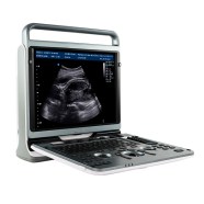 Ultrasonido Chison Ebit 50